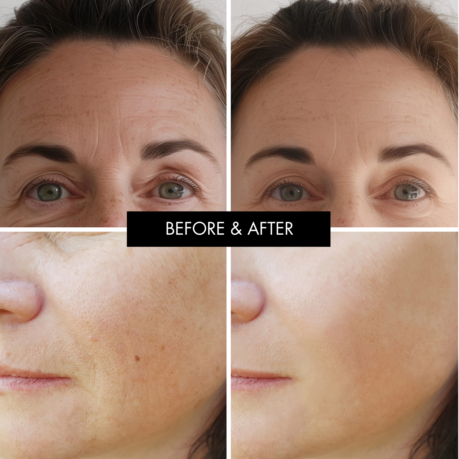 Jonassence Anti-Aging Skin Booster